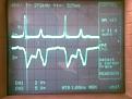 Click image for larger version

Name:	gad self oscillation #3- 400v, 272khz, shunt - zoom 2.jpg
Views:	46
Size:	230.1 KB
ID:	449131