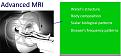 Click image for larger version

Name:	picture mri.jpg
Views:	15
Size:	54.3 KB
ID:	450910