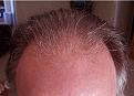 Click image for larger version

Name:	Kevin After 3.JPG
Views:	132
Size:	32.0 KB
ID:	463170