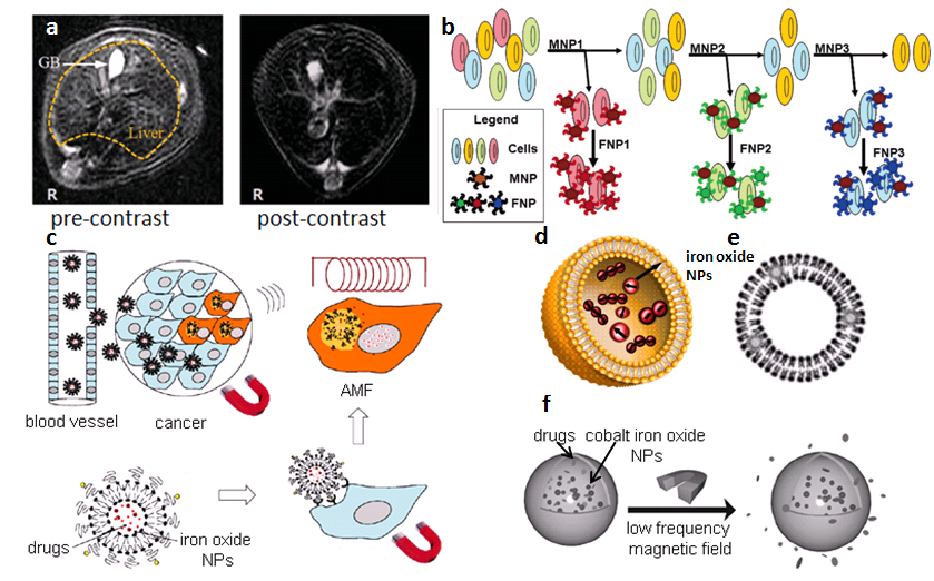 Click image for larger version

Name:	Scheme-1-Biomedical-applications-of-superparamagnetic-iron-oxide-nanoparticles-SPIONs.png
Views:	71
Size:	323.5 KB
ID:	506052